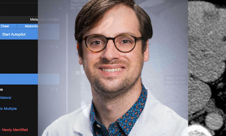 This radiologist is helping doctors see through the hype to an AI future – The Reporter